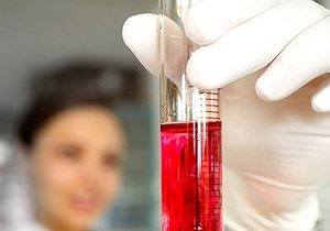 Expert Analysis: No Solid Evidence Tamiflu Prevents Swine Flu Complications