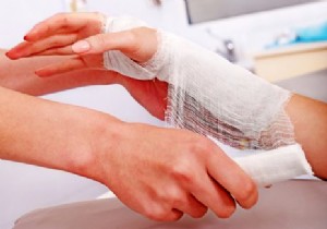 Burn Care Essentials: Proven First Aid Steps