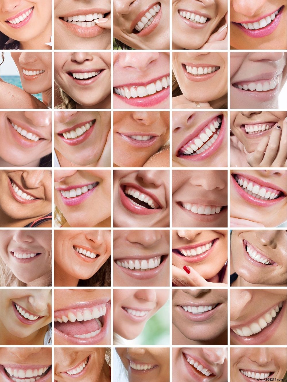 Elevate Your Oral Hygiene: Up to 30% Off Oral-B Nr.1 Packs This March at wehkamp.nl