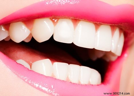 How to Prevent Cavities: Proven Tips from Dental Experts