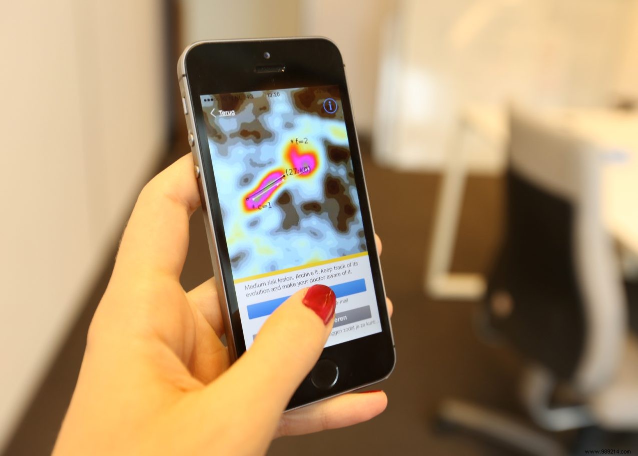 SkinVision App: AI-Powered Early Detection of Melanoma and Skin Cancer