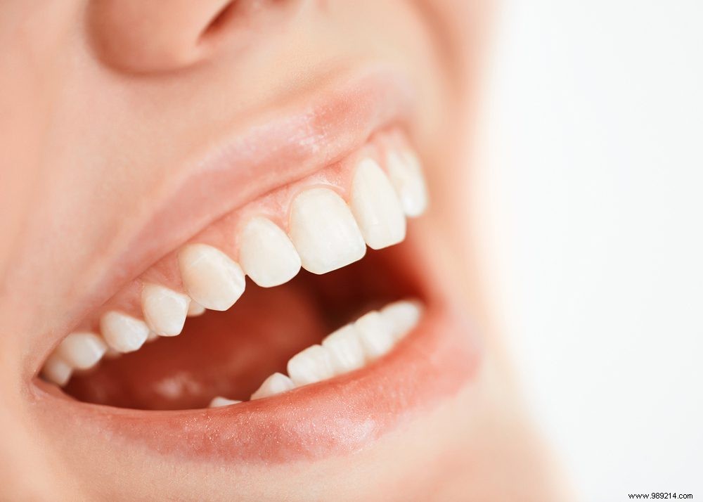 3 Everyday Foods That Strengthen Your Teeth and Gums