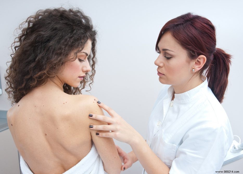 Spotting Dangerous Changes in Moles: When to See a Doctor