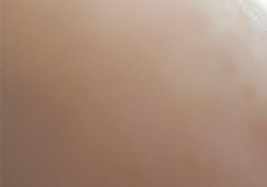 Why Do Mosquitoes Bite Some People More? 3 Science-Backed Reasons