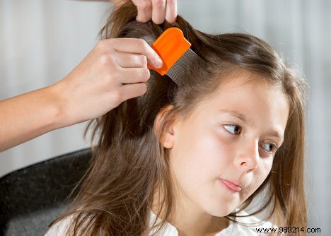 7 Expert Tips to Prevent Head Lice in Children