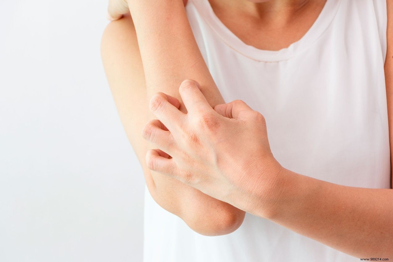 The Science of Why Scratching an Itch Feels So Irresistibly Good