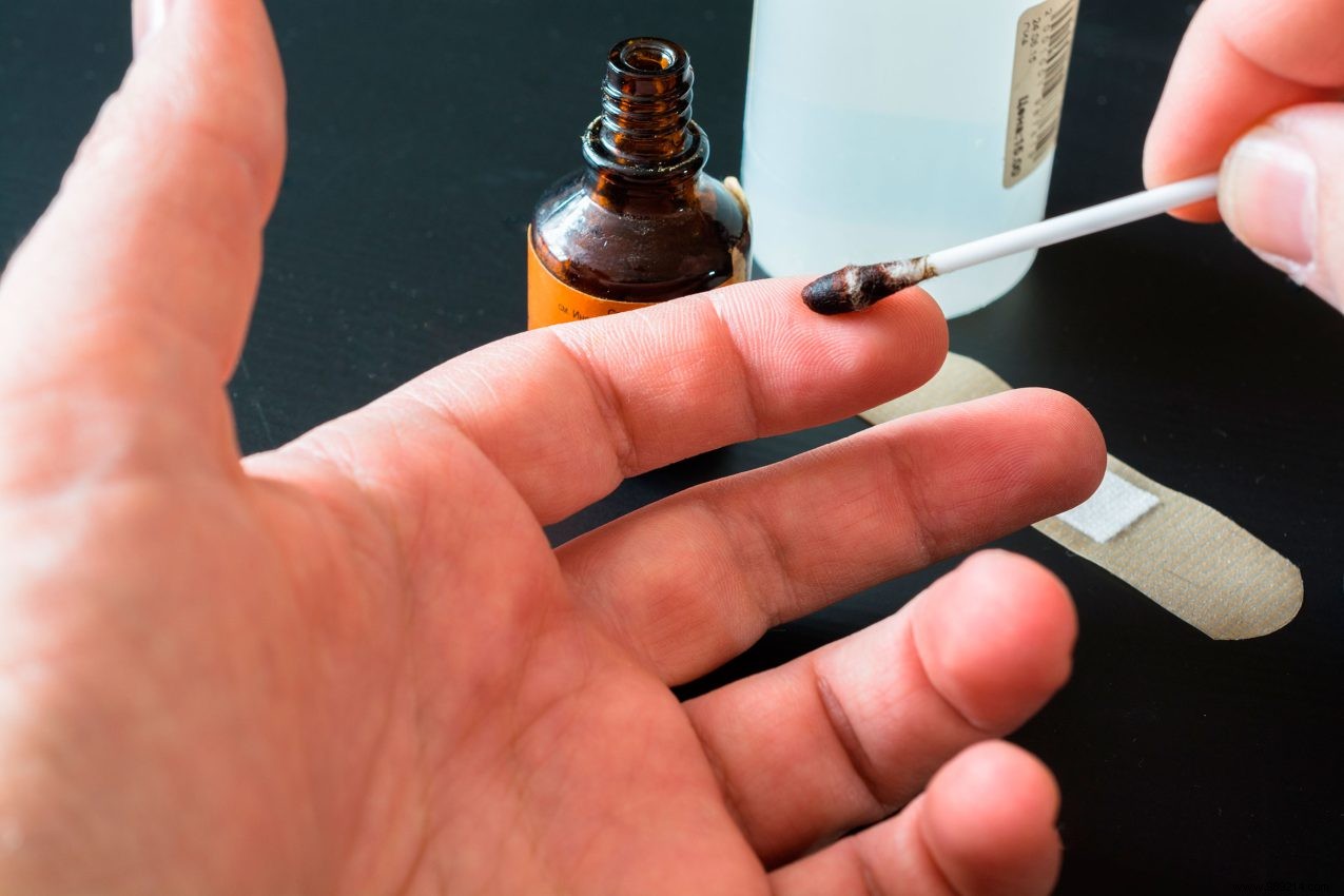 6 Effective Ways to Disinfect a Wound at Home