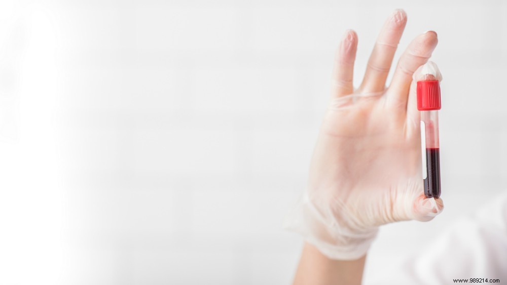 How Blood Transfusions Work: The Essential Guide to Blood Type Matching