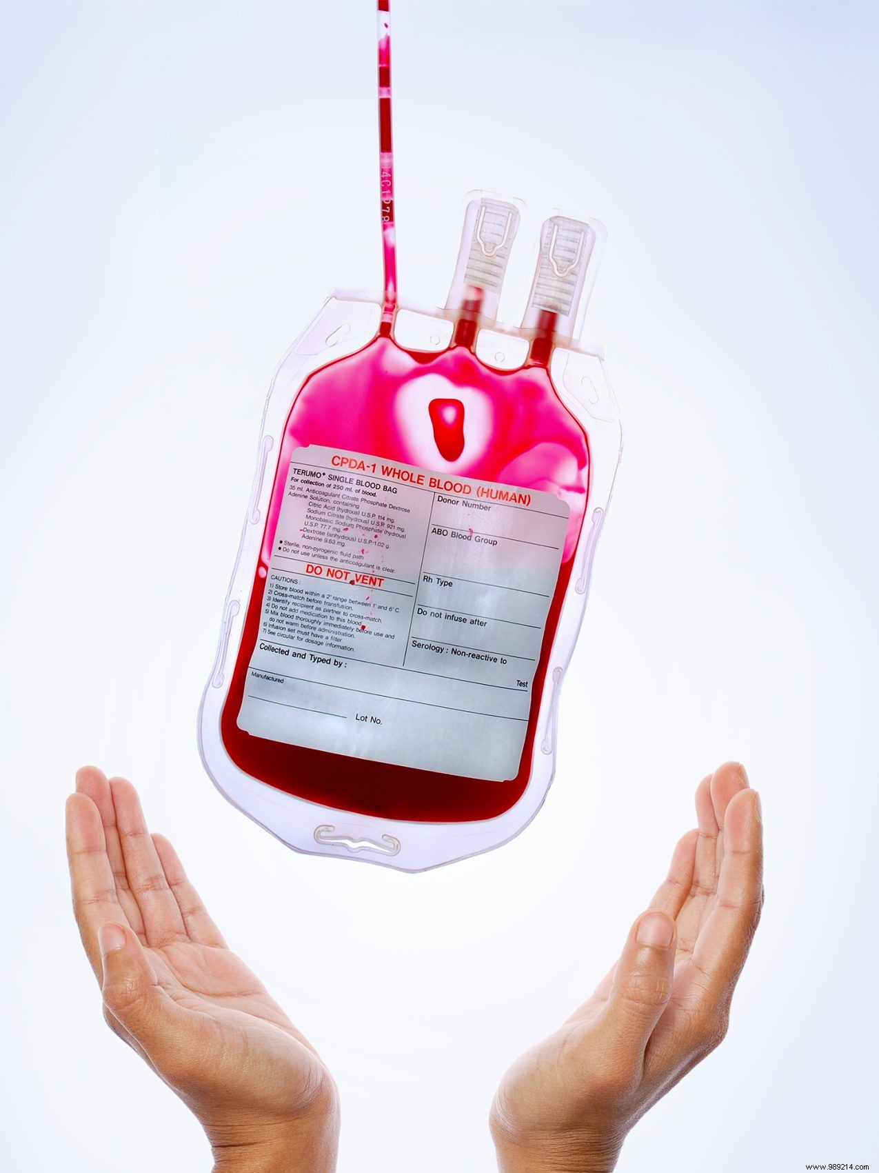Living Donations: What You Can Give While Still Alive – Blood, Kidneys, Hair, and More