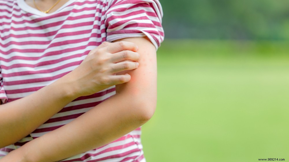 Why Do Mosquitoes Bite Some People More Than Others?