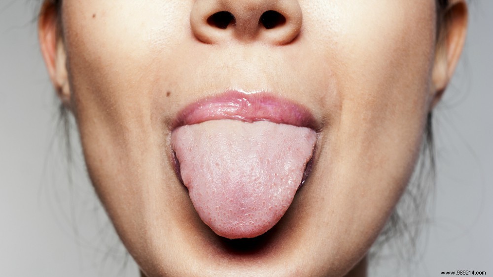 4 Proven Ways to Quickly Soothe a Burnt Tongue