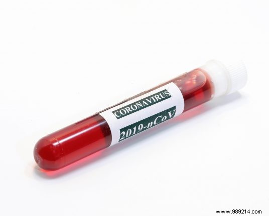 Coronavirus Outbreak Hits Northern Italy Hard: Fifth Fatality Confirmed