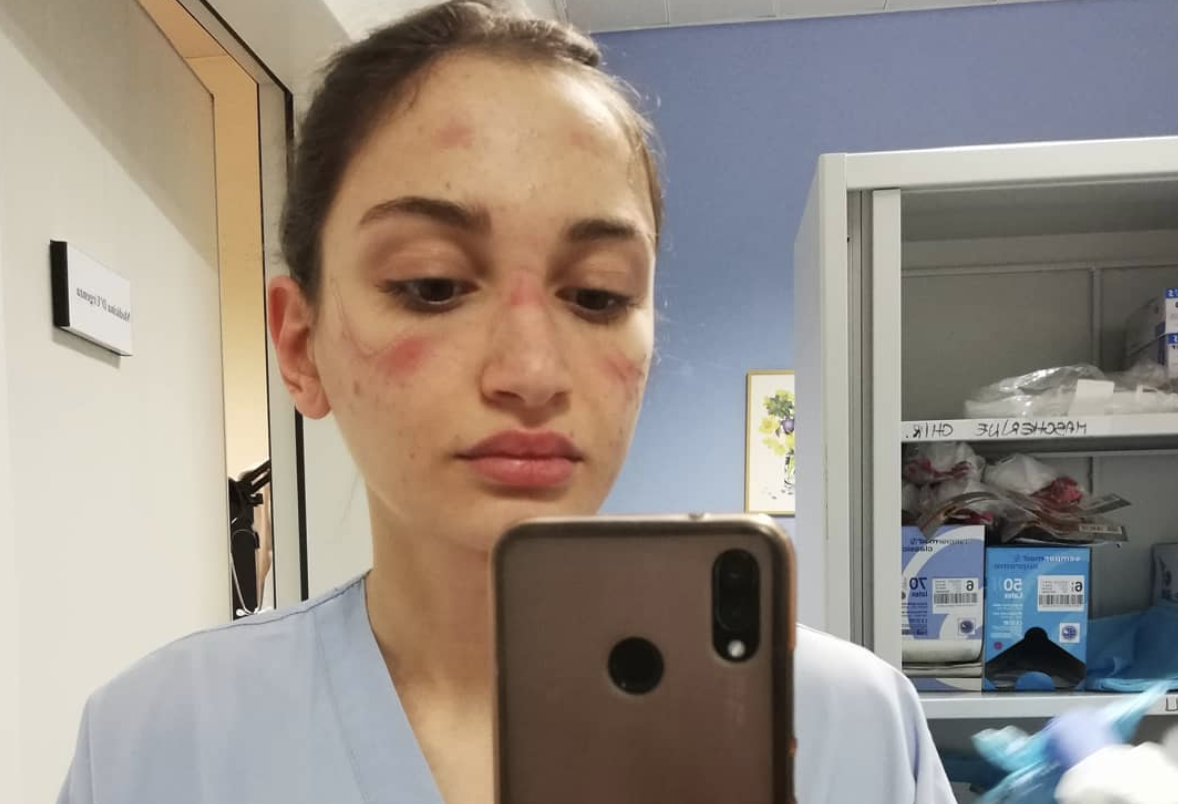 Exhausted Italian Doctors and Nurses Share COVID-19 Frontline Fatigue on Social Media