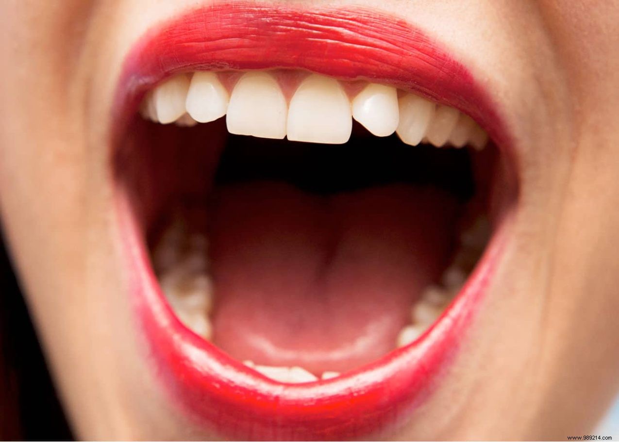 3 Proven Natural Remedies to Combat Bad Breath