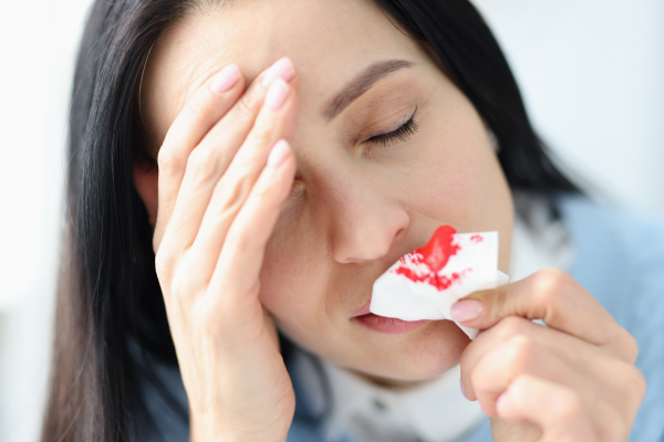 5 Common Causes of Nosebleeds and Proven Ways to Stop Them