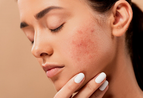 Expert Skin Care Tips for Healthier, Radiant Skin