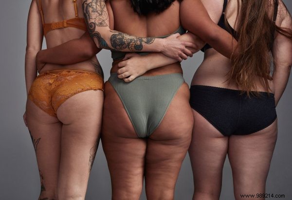 Cellulite Explained: Cosmetic Dermatology Expert Jetske Ultee Answers 3 Key Questions