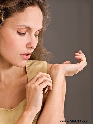 Kriebelwijzer: Expert Guide to Relieving Itchy Skin and Irritation