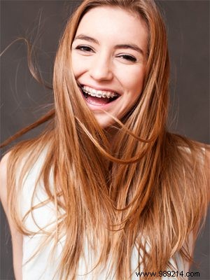 Asia s Surprising Dental Trends: Fake Braces as Fashion and Japan s Crooked Teeth Craze