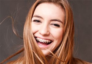 Asia s Surprising Dental Trends: Fake Braces as Fashion and Japan s Crooked Teeth Craze
