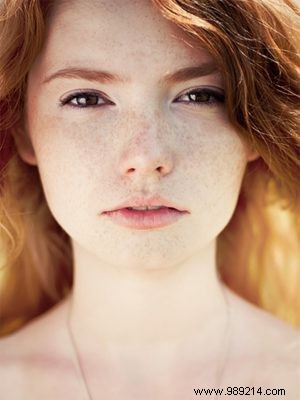 Freckles: The Secret to a Youthful, Fresh Look
