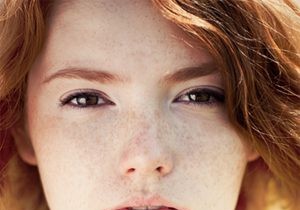 Freckles: The Secret to a Youthful, Fresh Look