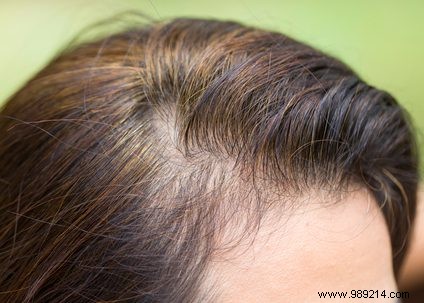 Conceal Gray Roots at Home: Skip the Salon with L Oréal Magic Retouch