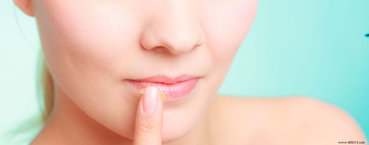 Why Skip Petroleum Jelly on Lips Before Heading Out in the Cold? Expert Frostbite Warning