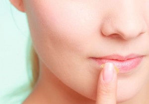 Why Skip Petroleum Jelly on Lips Before Heading Out in the Cold? Expert Frostbite Warning