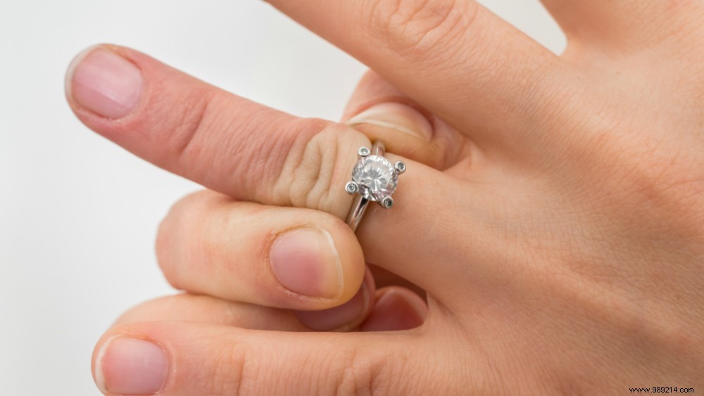 How to Safely Remove a Tight Ring from a Swollen Finger Without Cutting It