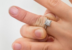 How to Safely Remove a Tight Ring from a Swollen Finger Without Cutting It