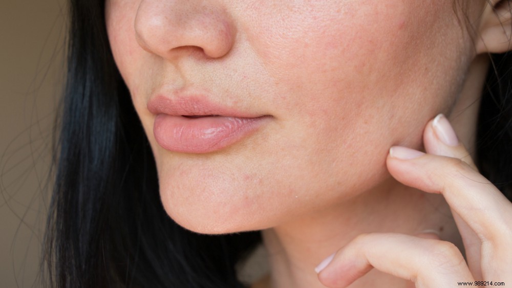 7 Surprising Causes of Dry Skin – Expert Insights and Solutions