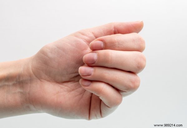 How to Eliminate Yellow Nails: Expert Tips for Brighter, Healthier Results