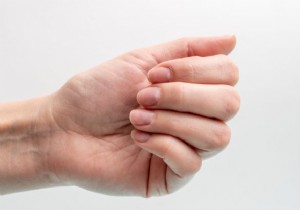 How to Eliminate Yellow Nails: Expert Tips for Brighter, Healthier Results