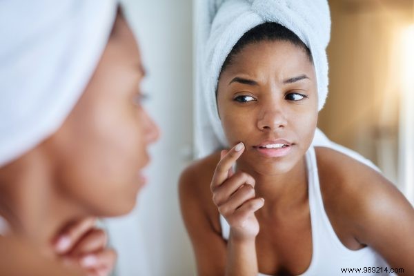 How to Get Rid of Pimples Fast: Expert Skincare Advice for Clear Skin