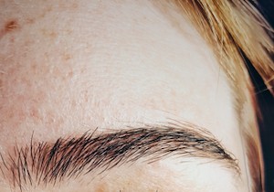 Skin Rejuvenation Guide: Eyebrow Lifts, Eyelid Corrections, Botox & Wrinkle Treatments