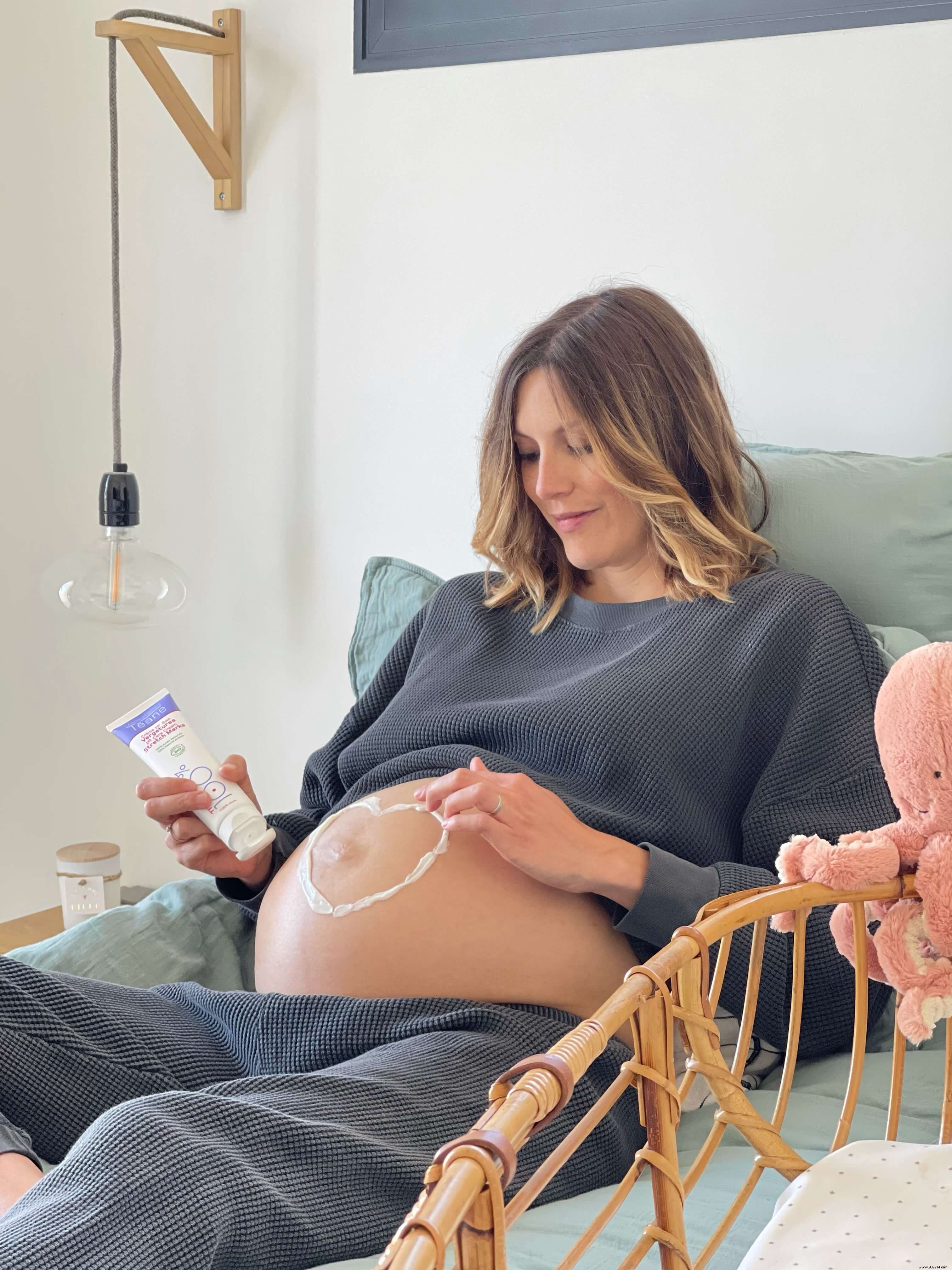 Preventing and Reducing Stretch Marks During Pregnancy: Proven Natural Strategies