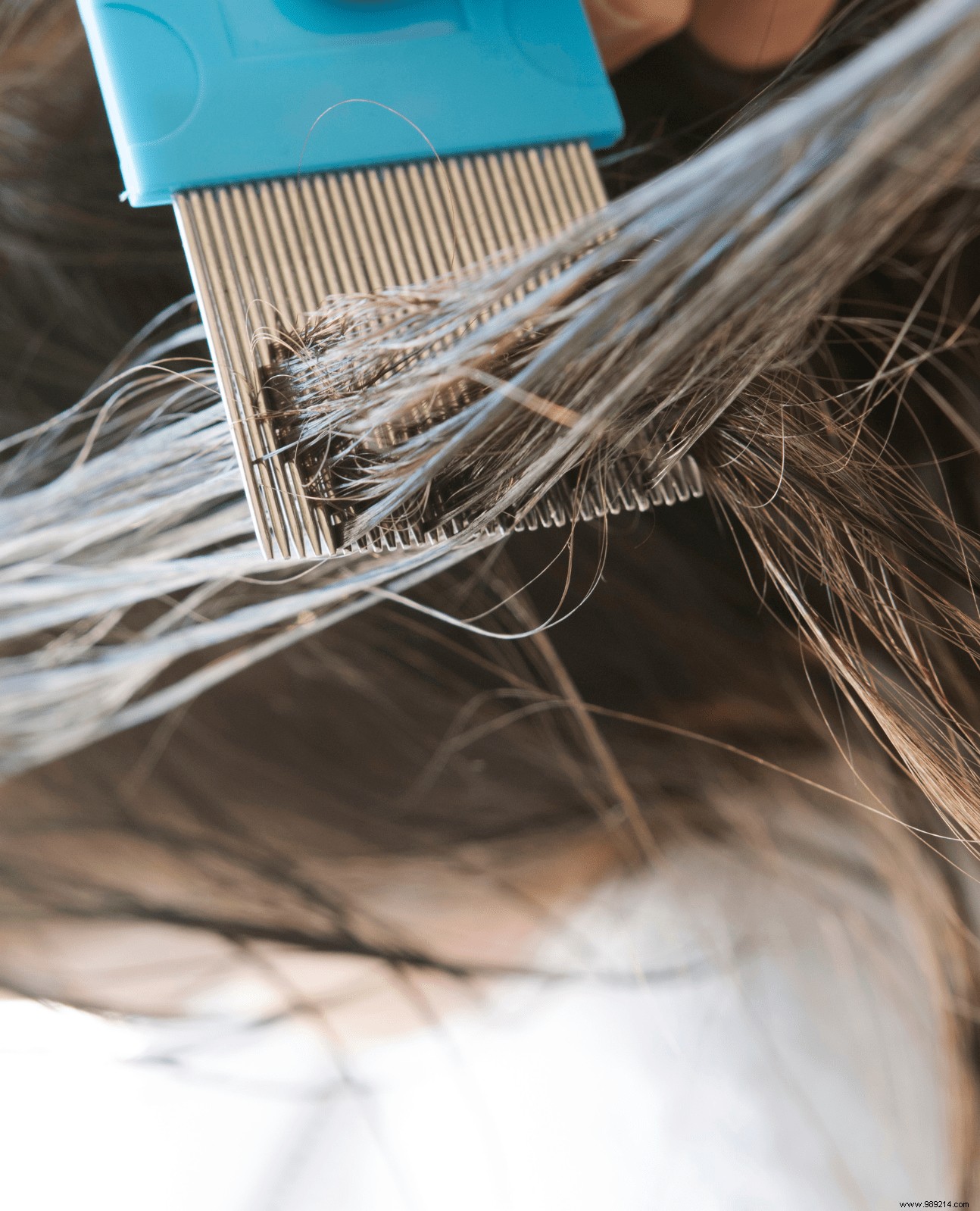Natural Head Lice Treatments: Proven Remedies to Eliminate Lice and Nits Safely