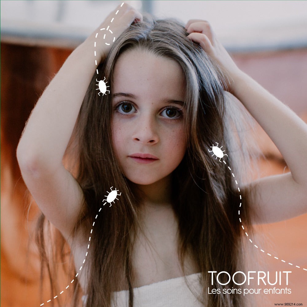 Natural Head Lice Treatments: Proven Remedies to Eliminate Lice and Nits Safely