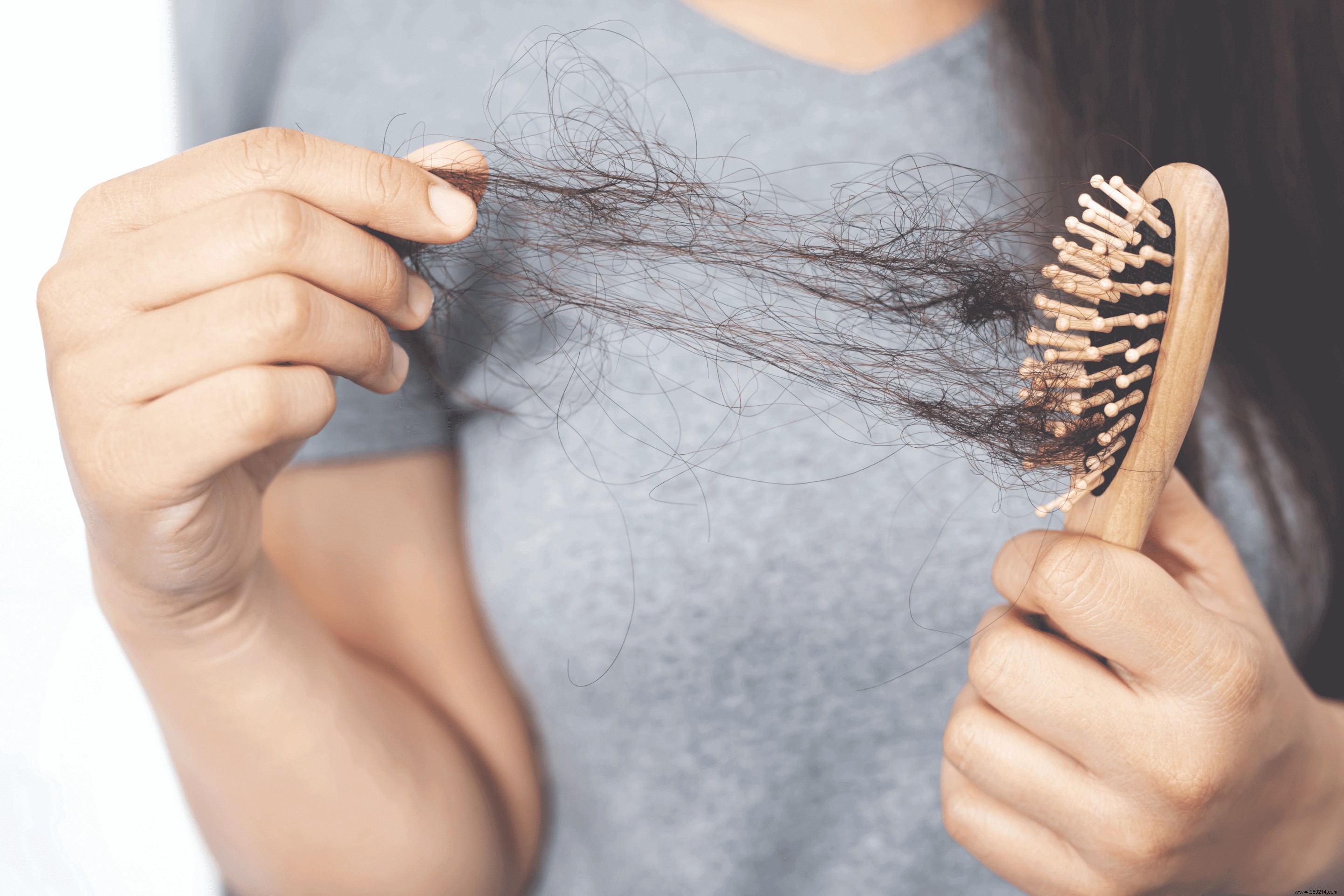 Preventing Seasonal Hair Loss: Expert Tips for Healthier Hair Year-Round