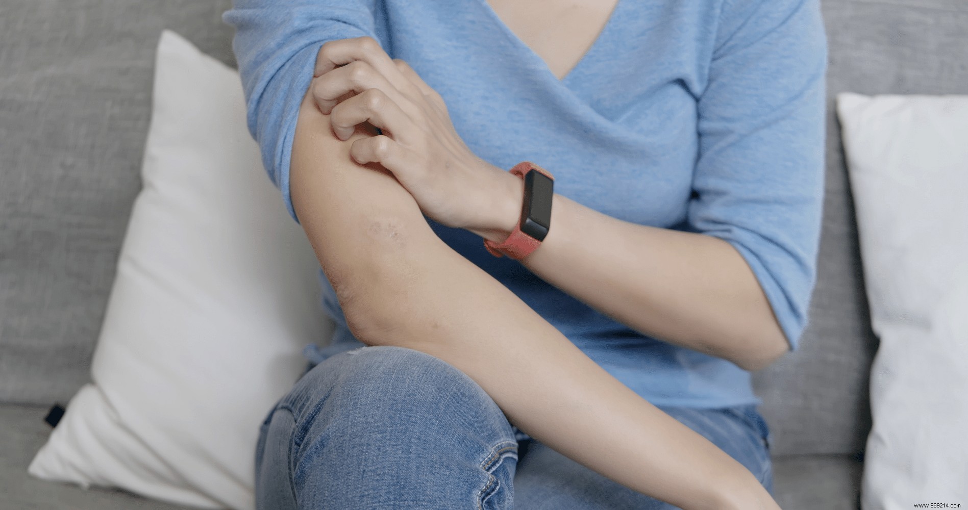 Natural Ways to Soothe Psoriasis Itching: Proven Tips from Personal Experience