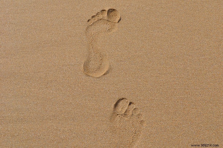 How to Treat and Prevent Foot Calluses: Proven Tips from Moroccan Skincare Experts