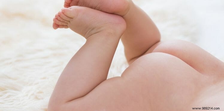 Diaper Rash in Babies: Causes, Prevention, and Effective Treatments