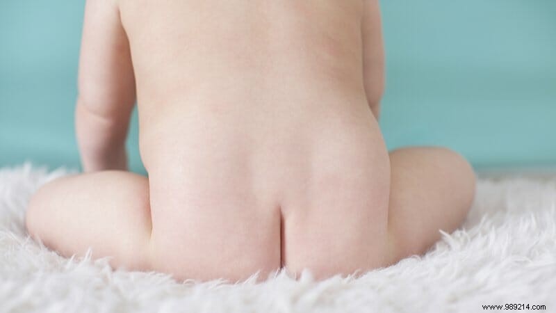 Diaper Rash in Babies: Causes, Prevention, and Effective Treatments