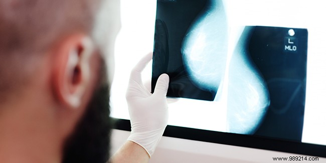 Breast Cancer Screening: Guidelines from Age 50 to 74 and Beyond