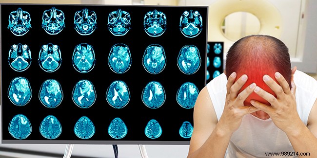 Stroke Warning Signs: Recognize FAST Symptoms and Respond Immediately