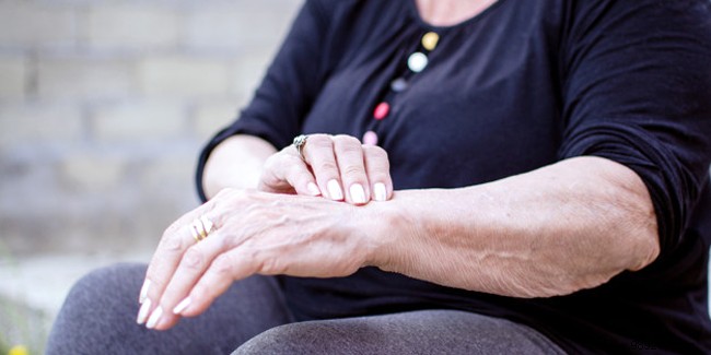 Joint Stiffness: Common Causes and Proven Relief Strategies