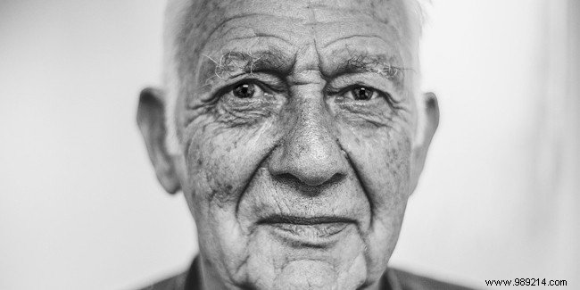 Why Skin Sags with Age: Causes and Proven Strategies to Minimize Sagging