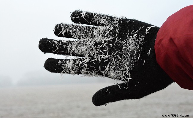 Frostbite: Symptoms, Causes, Treatments, and Prevention Guide