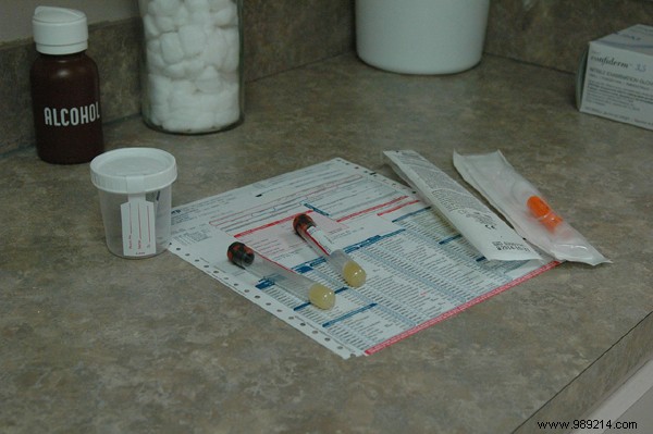 Urinary Tract Infections (UTIs) in Men and Women: Symptoms, Causes, and Proven Treatments